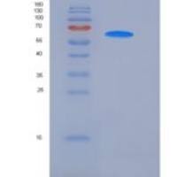 小鼠CD14分子(CD14)重组蛋白His & Fc tag