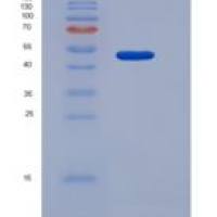 人CD122 / IL-2RB重组蛋白Fc tag