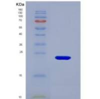 人醛脱氢酶1家族成员A3(ALDH1A3)重组蛋白