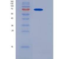 小鼠PCSK9 / NARC1重组蛋白His tag