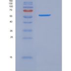 人IL17RA / CD217重组蛋白His & Fc tag