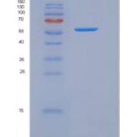 人IL17RA / CD217重组蛋白His & Fc tag