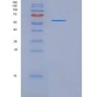 人SIGLEC6 / CD327重组蛋白Fc tag