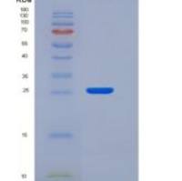 人CLM-9 / TREM4 / CD300LG重组蛋白His tag