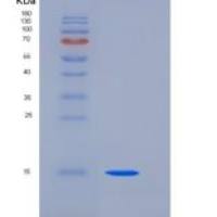 人CD82 / KAI-1重组蛋白His tag