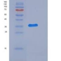 大鼠CD111 / Nectin-1 / PVRL1重组蛋白His tag