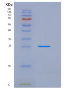 大鼠催乳素受体(PRLR)重组蛋白His tag