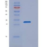 人骨症关联跨膜蛋白1(OSTM1)重组蛋白His tag