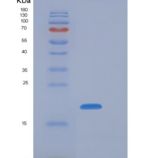小鼠NKG2A / NKG2 / CD159A / KLRC1重组蛋白His tag