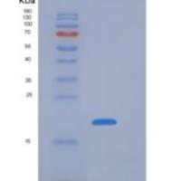 小鼠NKG2A / NKG2 / CD159A / KLRC1重组蛋白His tag