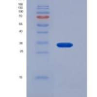 大鼠HAAO / 3-HAO重组蛋白His tag