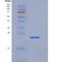 人LCN2 / NGAL重组蛋白His tag