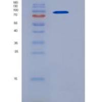 小鼠LDLR /低密度脂蛋白受体重组蛋白His tag