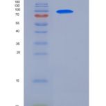 人GAD65 / GAD2 / GAD-2重组蛋白GST Tag