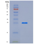 小鼠柯萨奇病毒腺病毒受体(CXADR)重组蛋白His tag