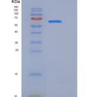 人CDCP1 / CD318重组蛋白Fc tag