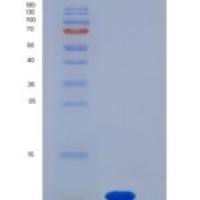 人S100A7 / PSOR1重组蛋白