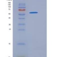 人CD93 / C1QR1重组蛋白His tag