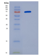 人B3GNT2重组蛋白Fc tag
