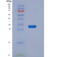 人MAP1D /蛋氨酸氨肽酶1D重组蛋白His tag