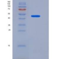 人CD31 / PECAM1重组蛋白His tag