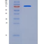 人内皮素转化酶1(ECE1)重组蛋白His tag