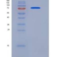 人内皮素转化酶1(ECE1)重组蛋白His tag