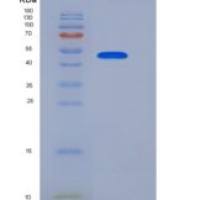 人NTPDase 2 / ENTPD2重组蛋白aa 29-460, His tag