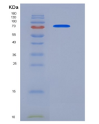 人内皮素转化酶1(ECE1)重组蛋白His tag