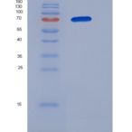 人B3GNT2重组蛋白Fc tag