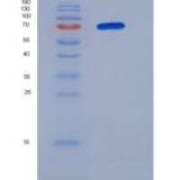 人B3GNT2重组蛋白Fc tag