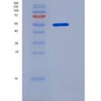 人PGD重组蛋白His Tag