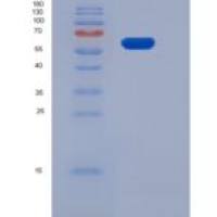 人EphB1 / EPHT2重组蛋白His tag