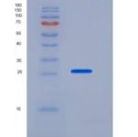 小鼠细胞程序性死亡蛋白1配体1(PDL1)重组蛋白His Tag