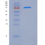 人白介素17受体C(IL17RC)重组蛋白Fc tag