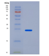 人CD200 / OX-2重组蛋白His tag