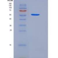 人tPA / PLAT重组蛋白Fc tag