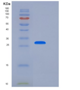 人CD33 / Siglec-3重组蛋白His tag