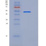 人CD33 / Siglec-3重组蛋白Fc tag