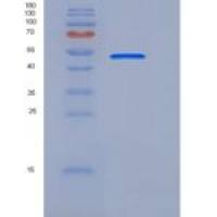 人CD33 / Siglec-3重组蛋白Fc tag