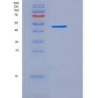 人CD200 / OX-2重组蛋白His & Fc tag