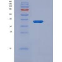 人MAPT / Tau重组蛋白His tag