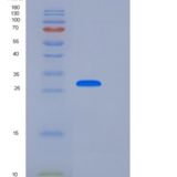 人CD33 / Siglec-3重组蛋白His tag