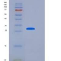 人CD33 / Siglec-3重组蛋白His tag