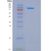 人甲状腺过氧化物酶/ TPO重组蛋白257 Ser/Ala, 725 Pro/Thr, His tag