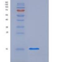 人L-FABP / FABP1重组蛋白His tag