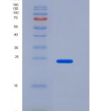 人CD200 / OX-2重组蛋白His tag