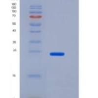 人CD200 / OX-2重组蛋白His tag