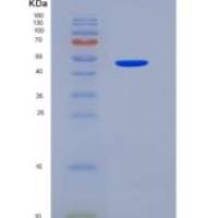人VNN1 / Vanin-1重组蛋白His tag