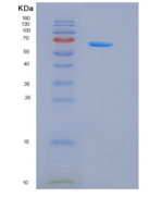 人G-CSFR / CD114 / CSF3R重组蛋白